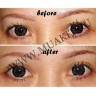 wm_double_eyelid_tape_before_afterzl.jpg