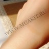 wm_eyelid_net7.jpg